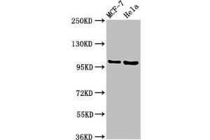 Western Blot Positive WB detected in: MCF-7 whole cell lysate, Hela whole cell lysate All lanes: NUP98 antibody at 3. (NUP98 Antikörper  (AA 965-1110))
