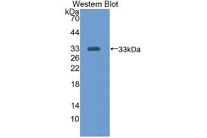 Western blot analysis of recombinant Mouse CS. (CS Antikörper  (AA 174-428))