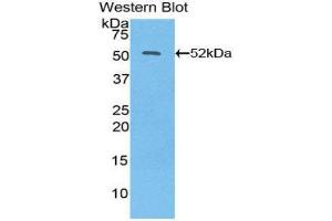 Western Blotting (WB) image for anti-Interferon, beta 1, Fibroblast (IFNB1) (AA 22-187) antibody (ABIN3209027) (IFNB1 Antikörper  (AA 22-187))