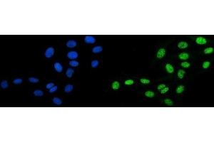 IF analysis of DBC-1/CCAR2 using anti-DBC-1/CCAR2 antibody (ABIN7602235).