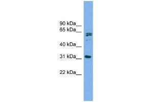 MITD1 antibody used at 1 ug/ml to detect target protein. (MITD1 Antikörper  (Middle Region))