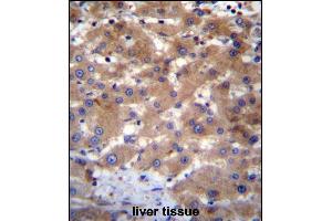 UBE2NL Antibody (N-term) (ABIN656527 and ABIN2845793) immunohistochemistry analysis in formalin fixed and paraffin embedded human liver tissue followed by peroxidase conjugation of the secondary antibody and DAB staining. (UBE2NL Antikörper  (N-Term))