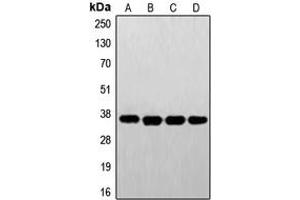 Western blot analysis of FR alpha expression in A431 (A), HeLa (B), HepG2 (C), JAR (D) whole cell lysates. (FOLR1 Antikörper  (Center))