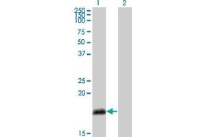 Western Blot analysis of NUMB expression in transfected 293T cell line by NUMB monoclonal antibody (M01), clone 4A7-A6. (NUMB Antikörper  (AA 1-135))