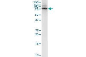 LIMK1 monoclonal antibody (M01), clone 1A8. (LIM Domain Kinase 1 Antikörper  (AA 548-647))