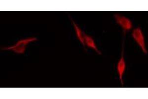 ABIN6276659 staining NIH-3T3 cells by IF/ICC. (CD44 Antikörper  (Internal Region))