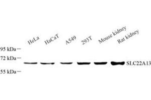Western blot analysis of SLC22A13 (ABIN7075661) at dilution of 1: 1000 (SLC22A13 Antikörper)
