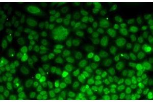 Immunofluorescence analysis of MCF7 cells using UFD1L Polyclonal Antibody