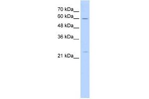 GINS1 antibody used at 5 ug/ml to detect target protein. (GINS1 Antikörper)