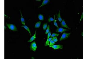 Immunofluorescence staining of Hela cells with ABIN7145343 at 1:133, counter-stained with DAPI. (Beclin 1 Antikörper  (AA 1-100))