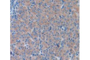 Used in DAB staining on fromalin fixed paraffin- embedded Kidney tissue (LCN5 Antikörper  (AA 28-187))