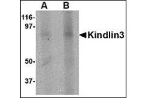 Western blot analysis of KINDLIN3 in rat spleen lysate with this product at (A) 1 and (B) 2 μg/ml.