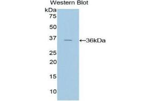 Western Blotting (WB) image for anti-Tissue Factor Pathway Inhibitor (Lipoprotein-Associated Coagulation Inhibitor) (TFPI) (AA 29-306) antibody (ABIN1078583)