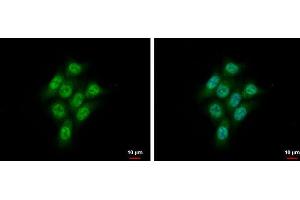ICC/IF Image CMPK1 antibody [N1C3] detects CMPK1 protein at cytoplasm and nucleus by immunofluorescent analysis.