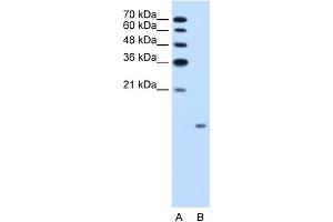 WB Suggested Anti-GCG Antibody Titration:  1. (Glucagon Antikörper  (N-Term))