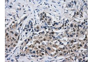 Immunohistochemical staining of paraffin-embedded Kidney tissue using anti-HDAC10mouse monoclonal antibody. (HDAC10 Antikörper)