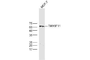 MCF-7 lysates probed with TM9SF1 Polyclonal Antibody, Unconjugated  at 1:300 dilution and 4˚C overnight incubation. (TM9SF1 Antikörper  (AA 51-150))
