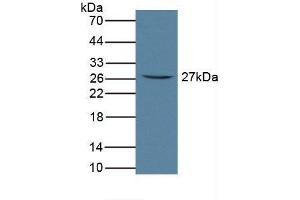 Detection of FcaR in Rat Serum using Polyclonal Antibody to Fc Fragment Of IgA Receptor (FcaR) (FCAR Antikörper  (AA 51-280))