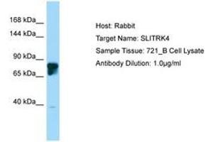 Image no. 1 for anti-SLIT and NTRK-Like Family, Member 4 (SLITRK4) (AA 661-710) antibody (ABIN6750228) (SLITRK4 Antikörper  (AA 661-710))