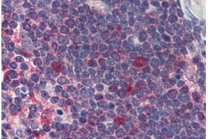 Thymus, Human: Formalin-Fixed, Paraffin-Embedded (FFPE) (CDK1 Antikörper)