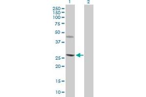 Western Blot analysis of CERK expression in transfected 293T cell line by CERK MaxPab polyclonal antibody. (CERK Antikörper  (AA 1-201))