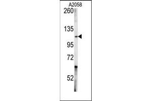 Image no. 1 for anti-C-Abl Oncogene 1, Non-Receptor tyrosine Kinase (ABL1) (Middle Region) antibody (ABIN359968) (ABL1 Antikörper  (Middle Region))