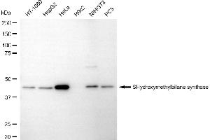 anti-Hydroxymethylbilane Synthase (HMBS) antibody