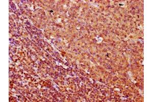 IHC image of ABIN7153151 diluted at 1:500 and staining in paraffin-embedded human tonsil tissue performed on a Leica BondTM system. (FREM1 Antikörper  (AA 1957-2082))