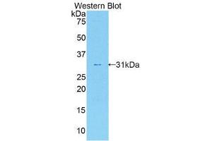 Western Blotting (WB) image for anti-Interleukin 17 Receptor A (IL17RA) (AA 590-848) antibody (ABIN1859358) (IL17RA Antikörper  (AA 590-848))