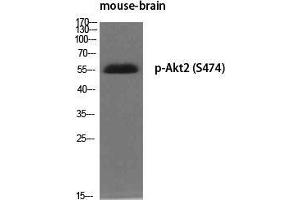 Western Blot (WB) analysis of specific cells using Phospho-Akt2 (S474) Polyclonal Antibody. (AKT2 Antikörper  (pSer474))