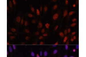 Immunofluorescence analysis of U-2 OS cells using HOXB1 Polyclonal Antibody at dilution of 1:100. (HOXB1 Antikörper)