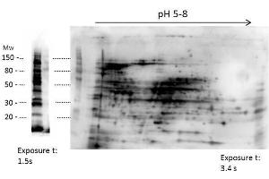 2D Western Blot of anti-E. (HMW HCP Antikörper)