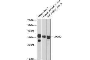 Western blot analysis of extracts of various cell lines, using MYOZ2 antibody (ABIN6129772, ABIN6144299, ABIN6144300 and ABIN6222126) at 1:1000 dilution. (MYOZ2 Antikörper  (AA 1-264))
