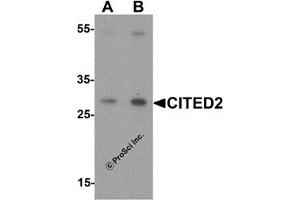 Western Blotting (WB) image for anti-Cbp/p300-Interacting Transactivator, with Glu/Asp-Rich Carboxy-terminal Domain, 2 (CITED2) (N-Term) antibody (ABIN1077387) (CITED2 Antikörper  (N-Term))