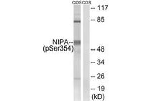 Western blot analysis of extracts from COS7 cells treated with HU 2nM 24h, using NIPA (Phospho-Ser354) Antibody. (ZC3HC1 Antikörper  (pSer354))