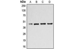 Western Blotting (WB) image for anti-UDP-Gal:betaGlcNAc beta 1,4- Galactosyltransferase, Polypeptide 3 (B4GALT3) (Center) antibody (ABIN7297432)
