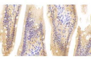 Detection of RBP2 in Mouse Small intestine Tissue using Polyclonal Antibody to Retinol Binding Protein 2, Cellular (RBP2) (RBP2 Antikörper  (AA 1-134))
