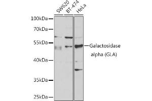 Western blot analysis of extracts of various cell lines, using Galactosidase alpha (Galactosidase alpha (GLA)) antibody (ABIN6131511, ABIN6141114, ABIN6141116 and ABIN6218799) at 1:1000 dilution. (GLA Antikörper  (AA 150-429))