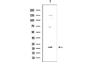 anti-Dual Specificity Phosphatase 22 (DUSP22) (Internal Region) antibody