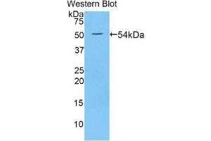 Western blot analysis of the recombinant protein. (WNT10A Antikörper  (AA 108-343))