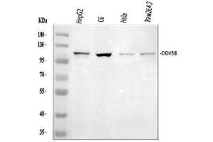 Western blot analysis of DDX58 using anti-DDX58 antibody (ABIN5518906). (DDX58 Antikörper  (AA 871-925))