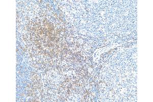 anti-CD28 (CD28) (AA 170-220) antibody