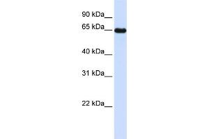 WB Suggested Anti-LMOD1 Antibody Titration: 0.