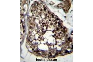 TBCEL Antibody (C-term) immunohistochemistry analysis in formalin fixed and paraffin embedded human testis tissue followed by peroxidase conjugation of the secondary antibody and DAB staining. (TBCEL Antikörper  (C-Term))