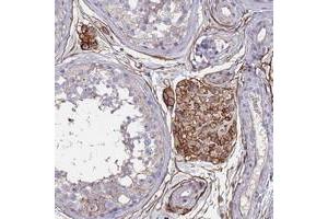 Immunohistochemical staining of human testis with ABCA8 polyclonal antibody  shows strong cytoplasmic and membranous positivity in Leydig cells at 1:50-1:200 dilution. (ABCA8 Antikörper)