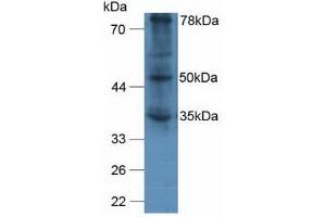 Figure. (VWA2 Antikörper  (AA 457-708))