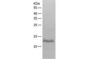 Western Blotting (WB) image for L-2-Hydroxyglutarate Dehydrogenase (L2HGDH) (AA 65-216) protein (His tag) (ABIN7123703) (L2HGDH Protein (AA 65-216) (His tag))