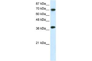 WB Suggested Anti-TCEA1 Antibody Titration:  0. (TCEA1 Antikörper  (N-Term))