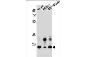 GFRA4 Antibody (Center) (ABIN657173 and ABIN2837905) western blot analysis in HL-60,ZR-75-1,MDA-M cell line lysates (35 μg/lane). (GFRA4 Antikörper  (AA 156-184))