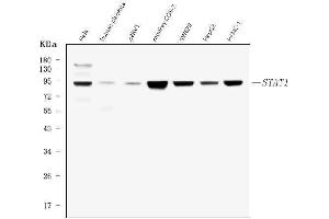 Western blot analysis of STAT1 using anti-STAT1 antibody (ABIN6719375).
